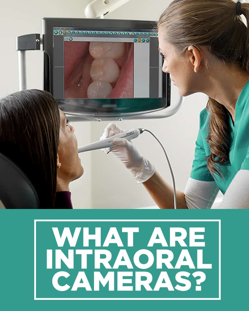 Dental Tools What are Intraoral Cameras Dental Offices
